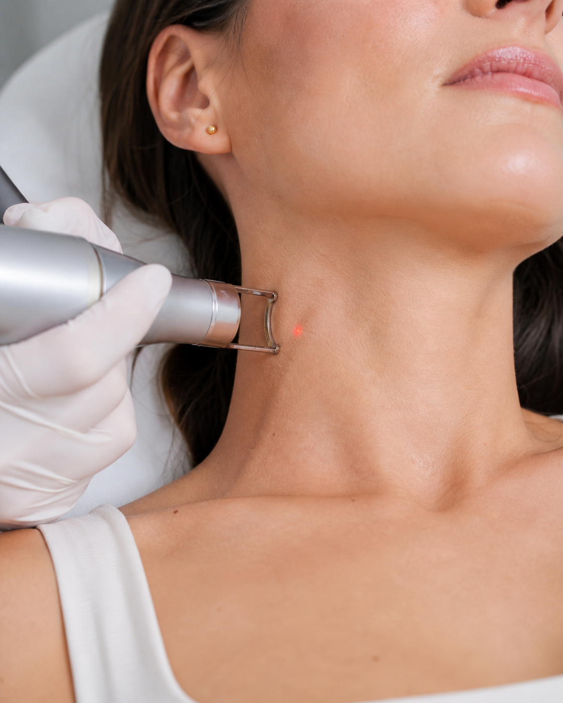 Traitement au laser Fotona chez Dermastructure à Blainville