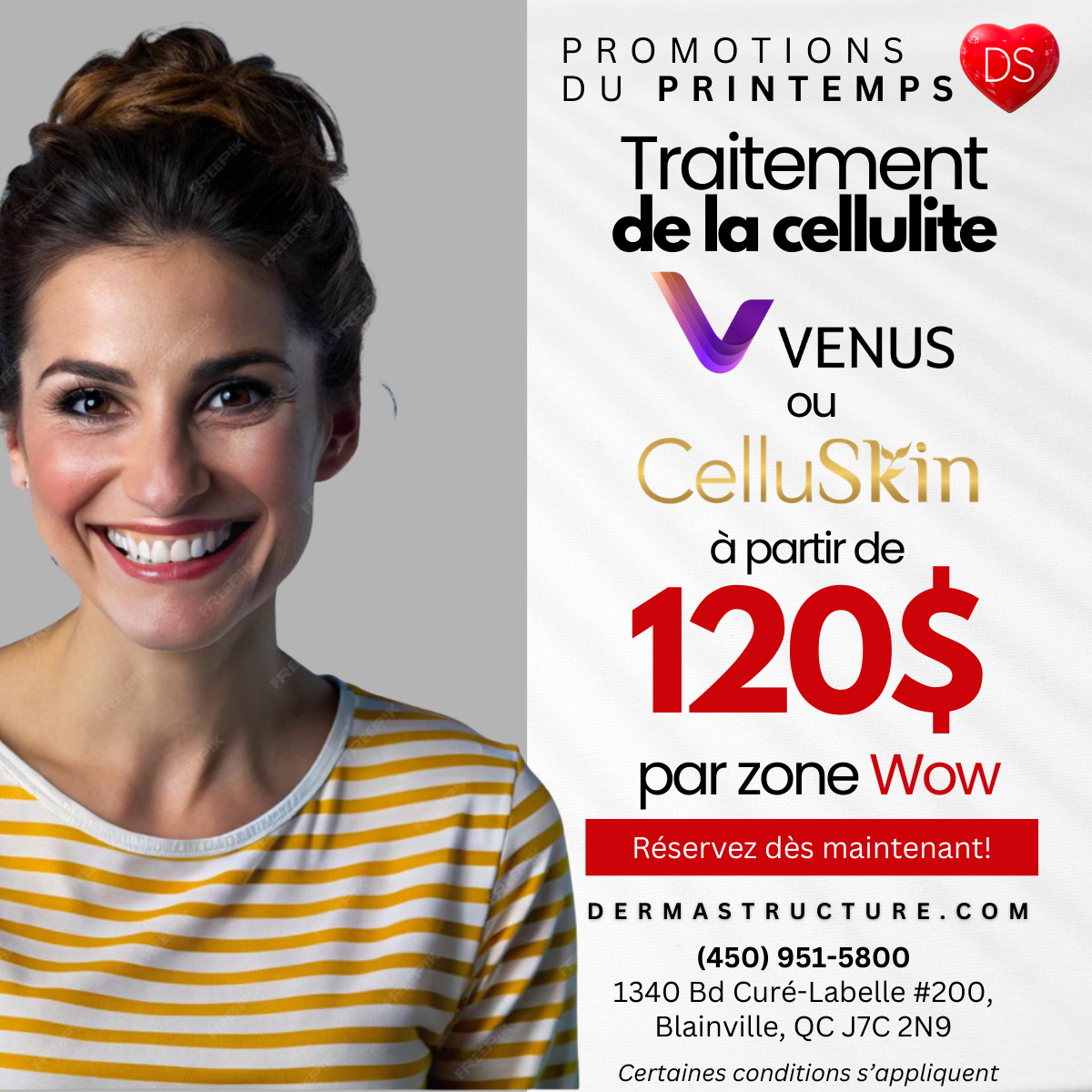 Promotion printanière sur les soins médico-esthétiques Dermastructure